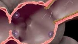 India, Philippines, Bangladesh, Singapore and Vietnam Ban Asbestos Video, English