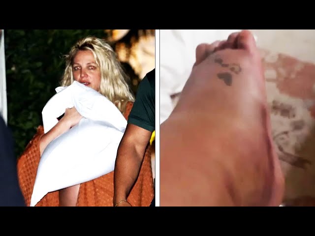 Britney Spears Shows Off Bruised Foot After Hotel Incident