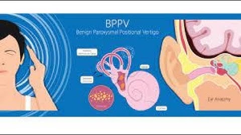 All about- BPPV (Benign Paroxysmal Positional Vertigo)