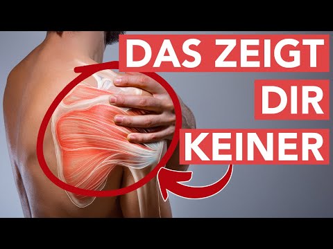 Is your shoulder hurting? Scapula alata could be the reason