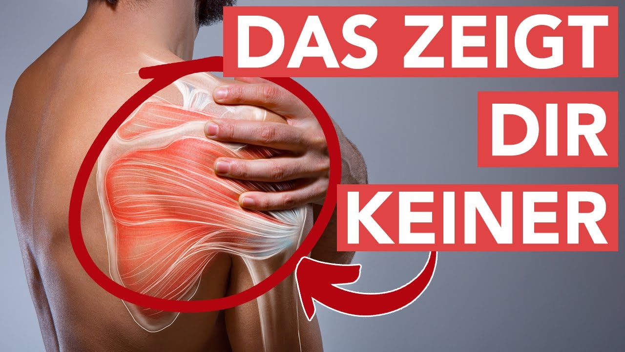 Scapula Alata - Ursache + Lösung mit diesen 3 Übungen