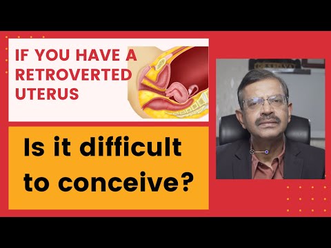 Retroverted uterus - is it difficult to conceive