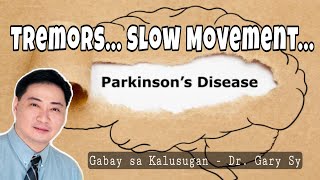 Parkinson's Disease  Dr. Gary Sy
