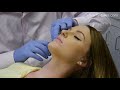 Juvederm Lip Fillers   Medical Spa   239 352 5554   Anti Aging