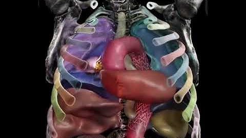 This is a display of a CT scan using cinematic rendering.