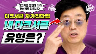 다크서클 자가진단법 공개! 유형에 맞는 치료 하세요 (양연모성형외과|의학박사 양연모)
