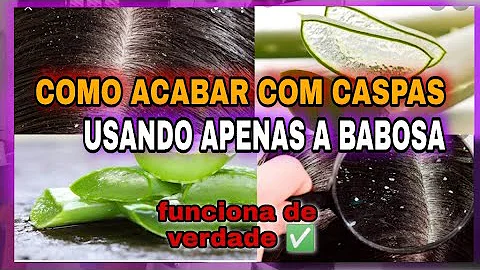 Como usar a babosa no cabelo para acabar com a caspa?