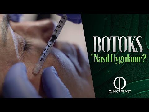 Video: Botoks Tedavisine Nasıl Hazırlanılır (Resimlerle)
