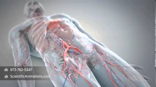 Cardiac Access Animation