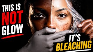 They Sold Skin Bleaching as Skincare (We Believed It)