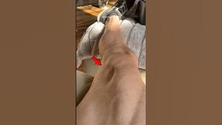 This is an easy way to treat leg cramps😨