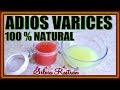 Elimina Varices 100% Natural Remedio Casero Y Muy Efectivo\\Silvia Rostran