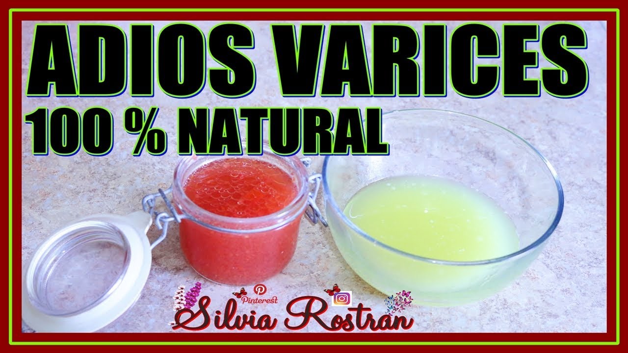 El venas varicosas natural de para tratamiento remedio
