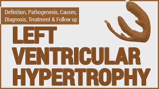 Left Ventricular Hypertrophy (LVH)  What is LVH, and how is it diagnosed & managed?