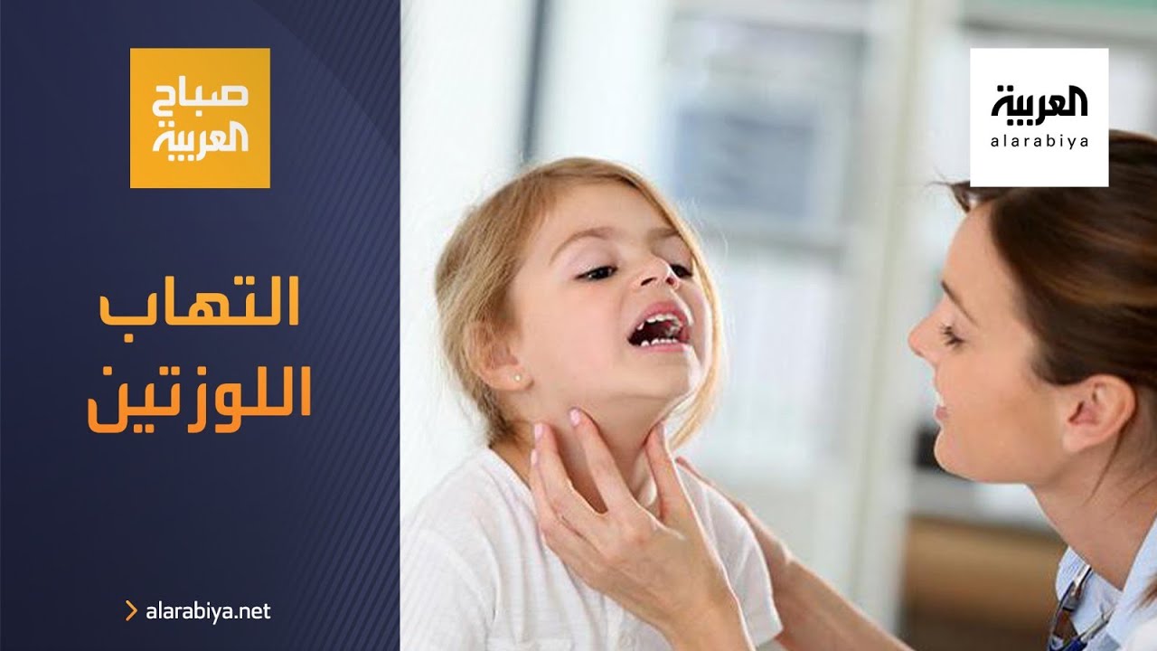 صورة فيديو : صباح العربية | أسباب وعلاجات التهاب اللوزتين عند الأطفال