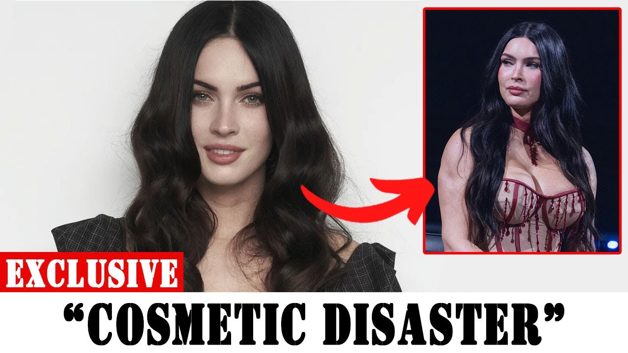 8 Hollywood Faces That Were Wrecked Forever by Buccal Fat Removal