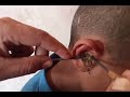 ASMR 시도 귀청소 – 궁극의 이완 사운드로 깊은 수면 유도