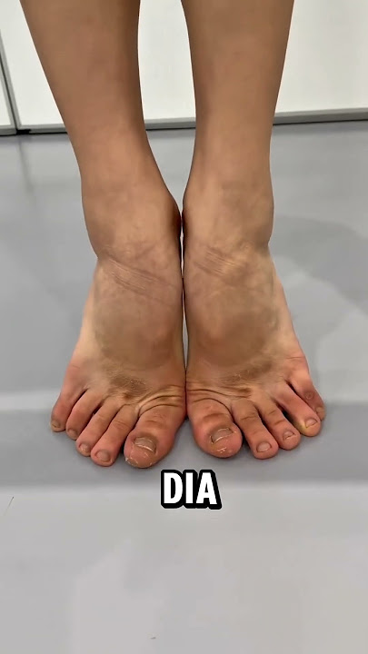 Training your feet to become a ballet dancer #viralvideo #trending #shorts