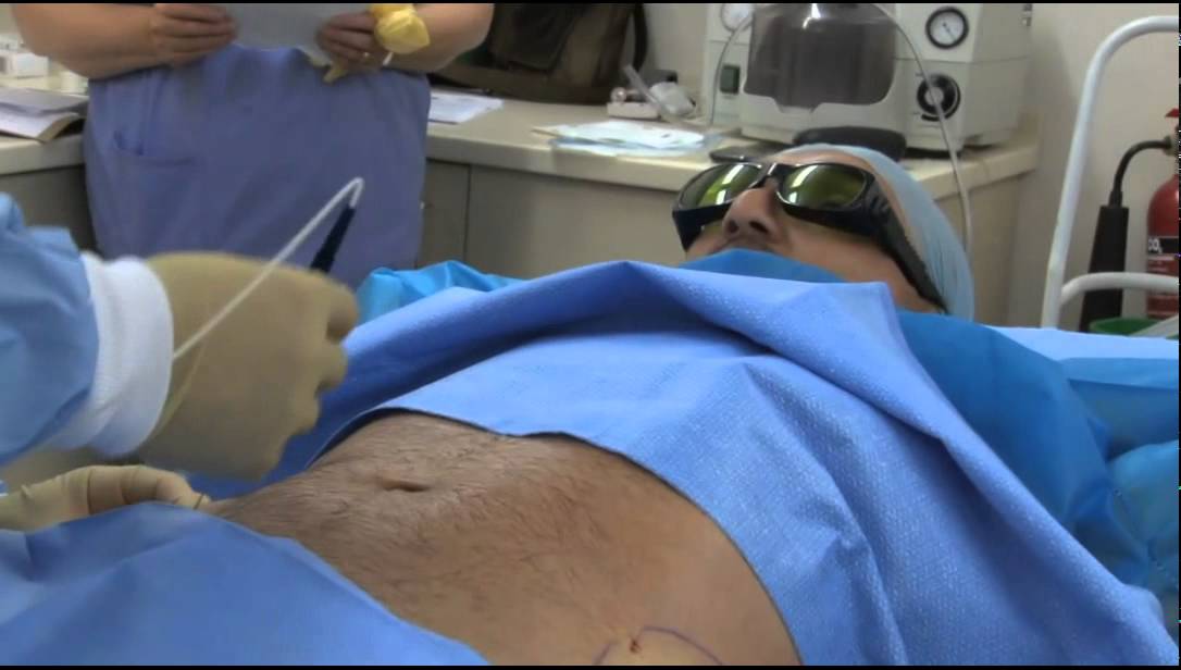 Laser Slim Video Youtube