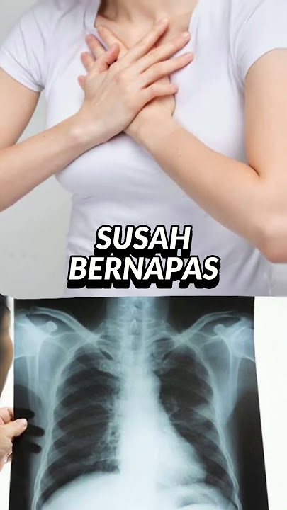 Tanda Jantung Kamu Tidak Sehat, Simak Gejalanya!🫀