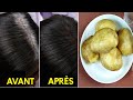 Transformer Les Cheveux Blancs En Noirs Après Avoir Utilisé Ce Remède À La Maison - 100% Naturel