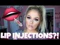 My Lip Injection Experience + Q&A