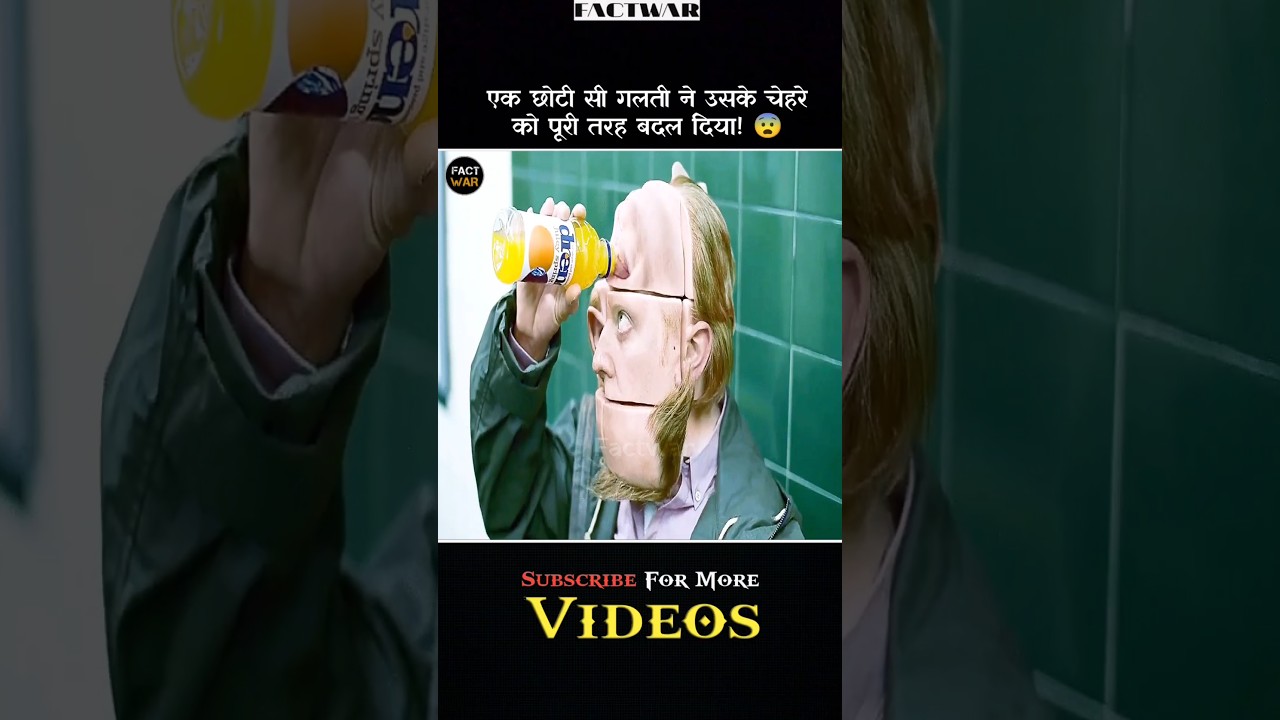 उसका चेहरा बदल गया #shorts