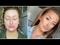 Foundation Routine For Acne How To Cover Spots!!