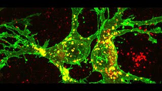 Lysosome presentation