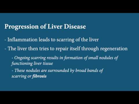 Liver Disease - Fibrosis