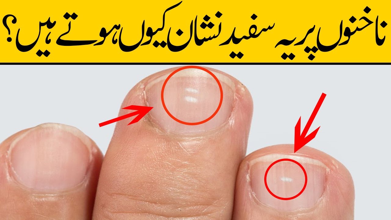 Nails,नाखूनों का रंग बदलना कई बीमारियों का है संकेत - changing color of nails  indicate many diseases - Navbharat Times