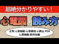 【一発理解！】心電図のわかりやすい読み方〜正常・心室細動・心室頻拍・心静止・PEA・心房細動・期外収縮〜