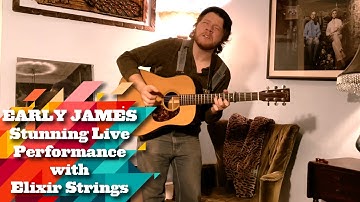 Early James STUNNING live performance with Elixir Strings