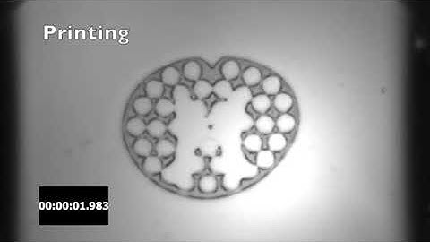 Researchers 3D printed a working spinal chord implant in 1.6 seconds