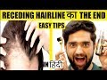 How to stop hair Fall, hair loss and RECEDING HAIRLINE | REGROW HAIR - urbangabru hair growth oil
