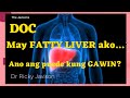 How to treat your fatty liver gawin mo ito usapang atay with dr ricky javison