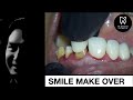 SMILE MAKE OVER | DENTIST | DR RIZAL RIZKY AKBAR