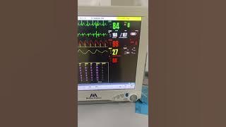 Monitor Icu #intensivecareunit