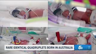 Australian mother gives birth to rare identical quadruplets | The Daily Brew