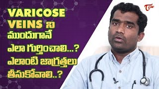 What Is Varicose Veins & How Can It Be Treated ? | Dr. Shailesh Kumar Garge | TeluguOne