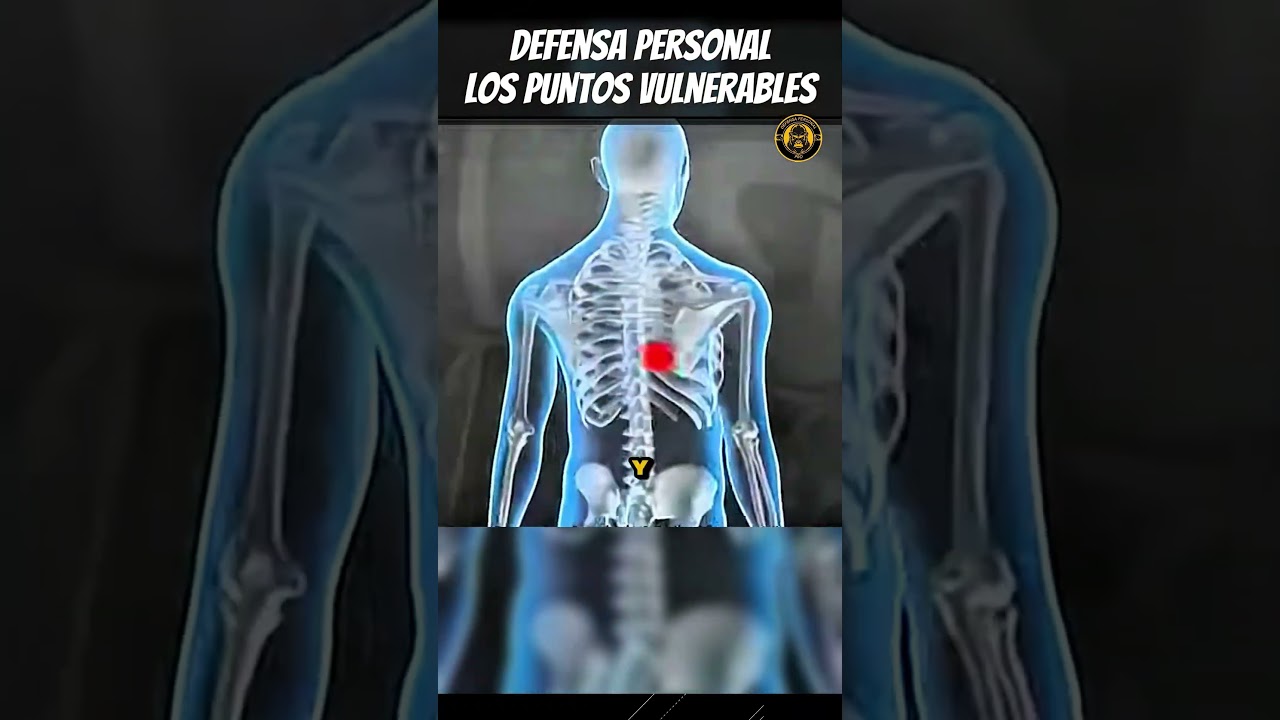 En la CALLE pocos saben Esto: el Cuerpo tiene Puntos Débiles que puedes usar para Defenderte 🥷🔥 #mma