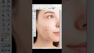 Remove Pimples shorts photo photoshop viral tutorial
