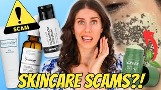 Don’t Waste Your Money On Acne Products — Skincare Scams To Watch For & What To Know!