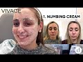 Vivace RF Microneedling | Patient Review