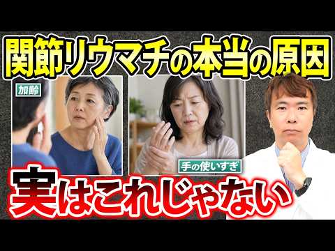 意外と知られていない、関節リウマチになる人の特徴