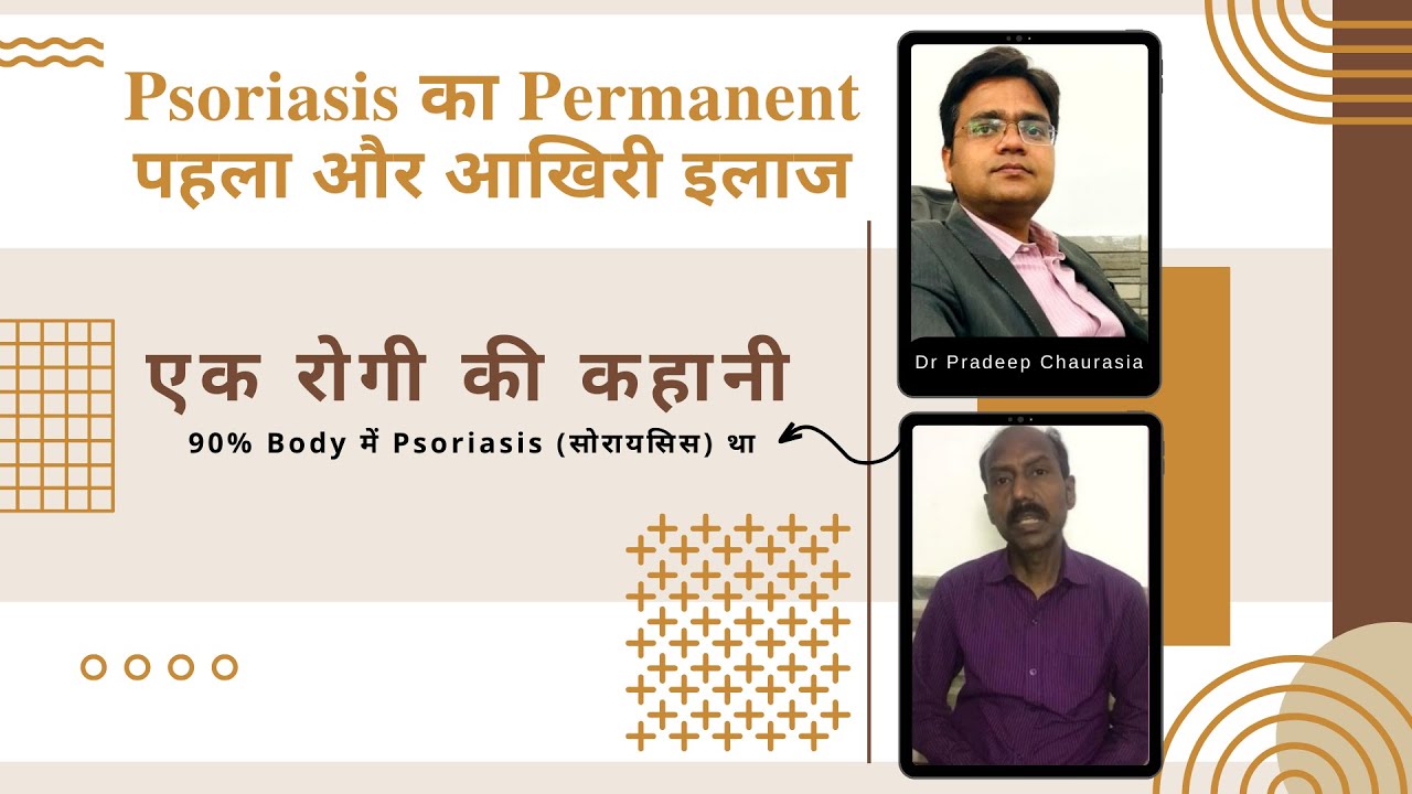 DJI Ayurveda Testimonial Psoriasis Cure by Ayurveda YouTube