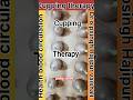 Cupping therapy #cupping #youtubeshorts #therapy #ytshorts