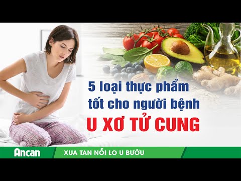 5 loại thực phẩm tốt cho bệnh u xơ tử cung