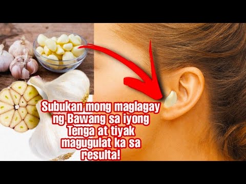 Video: Iba't-ibang Bawang