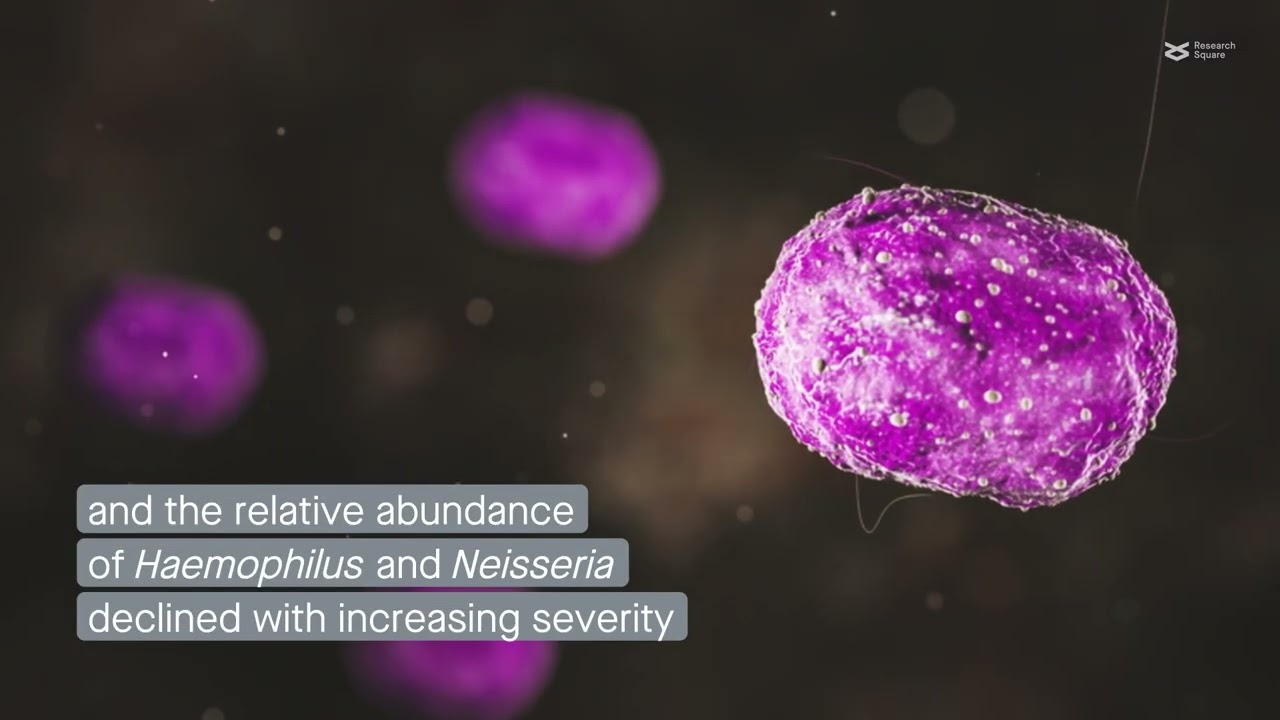 Alterations in the respiratory tract microbiome in COVID-19: current observations and potential
